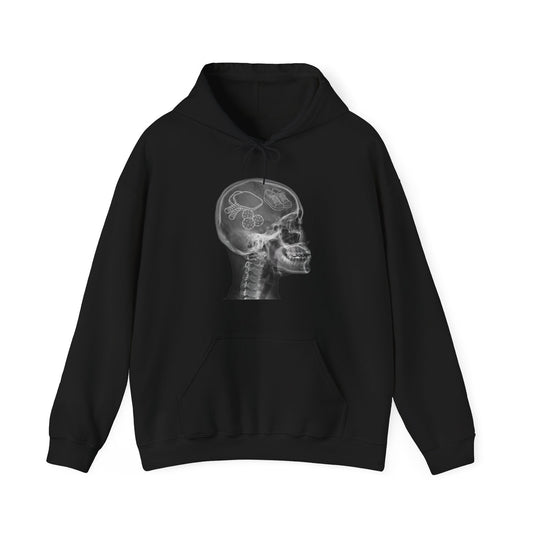 X-RAY PICKLEBALL - Pickleball (Hoodie)