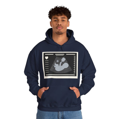 BORN TO DINK - Pickleball (Hoodie)