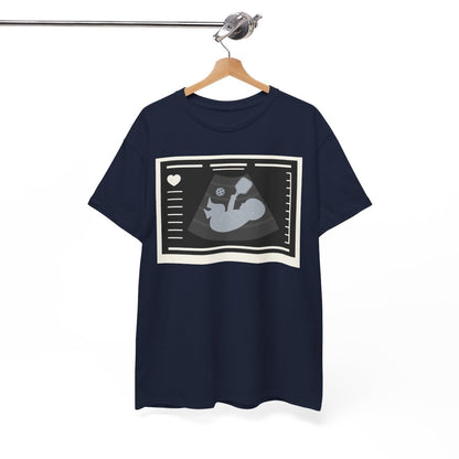BORN TO DINK - Pickleball (Basic Tee)
