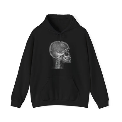 X-RAY TENNIS - Tennis (Hoodie)