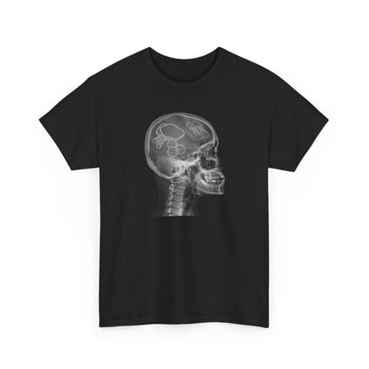 X-RAY PICKLEBALL - Pickleball (Kids Tee)