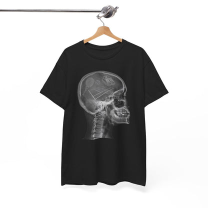 X-RAY TENNIS - Tennis (Basic Tee)