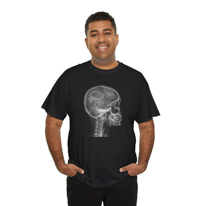 X-RAY PICKLEBALL - Pickleball (Dri Fit)