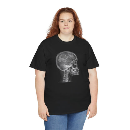 X-RAY PICKLEBALL - Pickleball (Basic Tee)